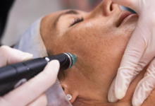 Discover the Benefits of Hydrafacial Treatment in Sydney