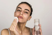 Effective Skin Care Range for Acne: How Synergie Skin Transforms Acne-Prone Complexions